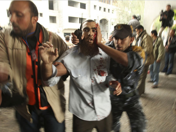 An injured man reaches out for help as hundreds of Palestinians are also killed and scores more wounded in the first hour of Israels massive attack on about 100 Hamas sites throughout Gaza in retaliation for the recent rocket fire from the area, Gaza, December 27, 2008.