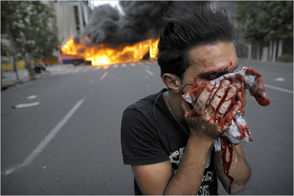 An supporter of the opposition candidate Mir Hussein Moussavi is injured during a protest against the Iranian government's declaration that President Mahmoud Ahmadinejad was the clear winner in the nation's presidential elections, Tehran, June 13, 2009.