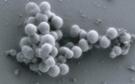 A scanning electron micrographs of synthetic mycoides cells 'M. mycoides JCVI-syn1,' the J. Craig Venter Institute, May 2010.